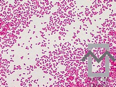 haemophilus influenzae type  gram stain