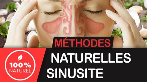 Comment soigner la sinusite méthode naturelle YouTube