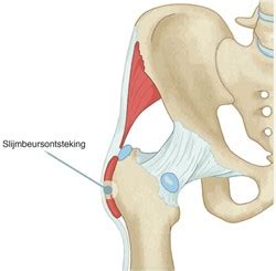 Tom Cerntrum Fysiotherapie Heup Bekken