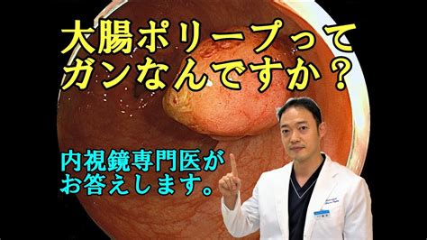 大腸ポリープは、大腸ガンになるのか？ポリープと癌の関係について解説。大腸ポリープの中でも腺腫を切り取るとガン予防になります。 Youtube