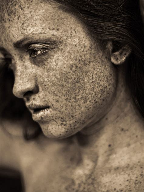 Freckles All Over Body