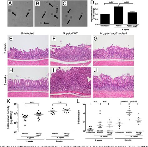 Figure From Targeted Mobilization Of Lrig Gastric Epithelial Stem