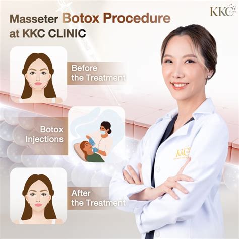 Masseter Botox Injections For Jawline Slimming Kkc Clinic