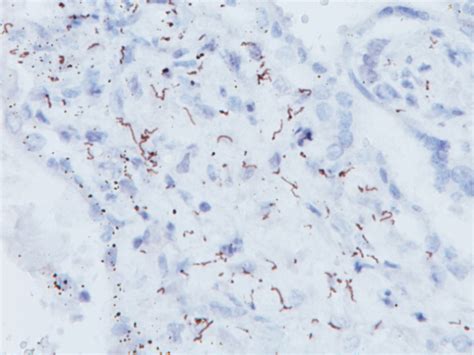 Treponema Pallidum Antibody Bicoare Medical