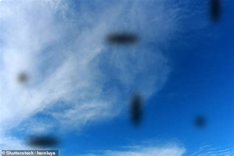 Australian Eye Expert Explains Science Behind The ‘floaters You See After Looking At Bright