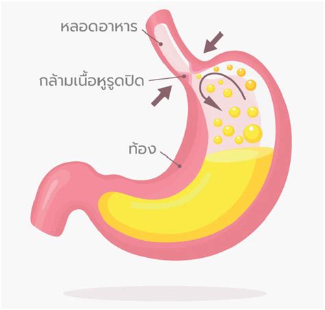 รายการ 98 ภาพพื้นหลัง กล้าม เนื้อ หูรูด กระเพาะ อาหาร อัปเดต