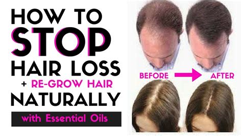 How To Stop Hair Loss And Regrow Hair Naturally Stop Thinning Hair With Just A Few Drops Of This