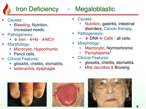 PPT - Anemia2 deficiency anemias PowerPoint Presentation, free download - ID:8201963