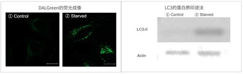 Dalgreen Autophagy Detection 细胞自噬检测试剂货号：d675 日本同仁化学 Dojindo代理商