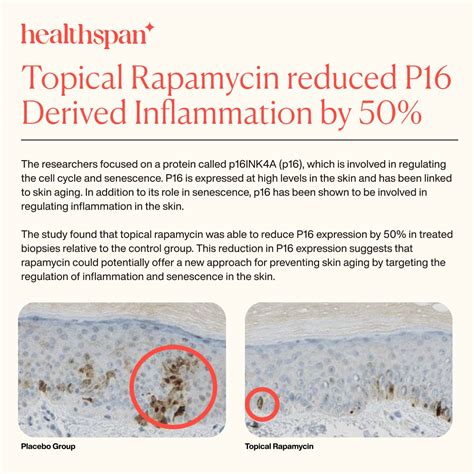 Healthspan On Twitter Rapamycin Reduces The Total Amount Of Senescent