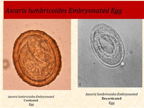 Ascaris Lumbricoides Decorticated Egg