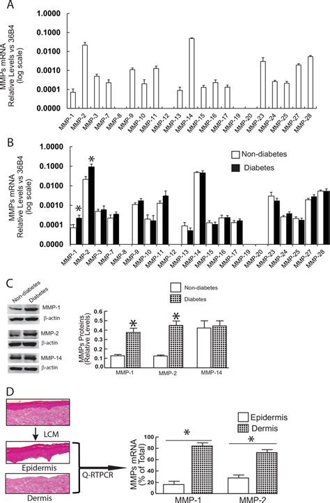 Elevated Expression Of MMP 1 And MMP 2 In Diabetic Human Skin Dermis In