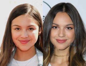 Olivia Rodrigo Plastic Surgery Boob Job And Lip Injections