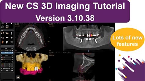 New CS 3D Imaging Tutorial Version 3 10 38 YouTube