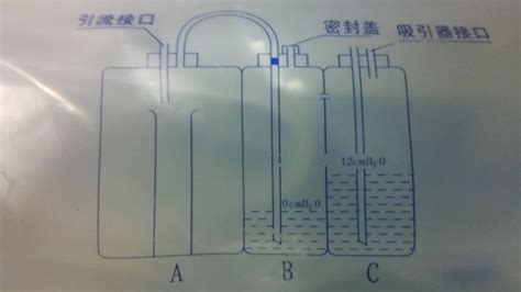 关于胸腔闭式引流，你知道多少？凤凰网