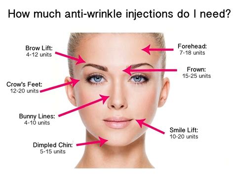 How Much Anti Wrinkle Injections Do You Need Dr Lindsay Moran