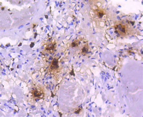 Mast Cell Tryptase Rabbit mAb - SAB | Signalway Antibody