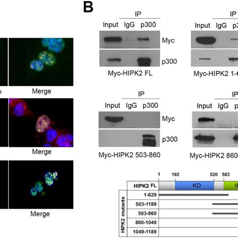 Hipk2 Interacted With P300 In The Nuclear Speckles A Hek293 Cells Download Scientific