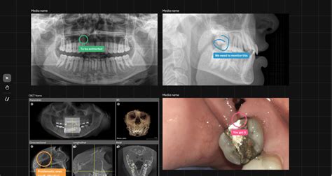 Dentsply Sirona Adds New Functions To DS Core Orthodontic Products