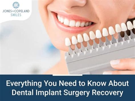 Know Everything About Dental Implant Surgery Recovery