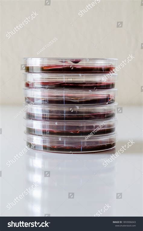 Characteristic Mucoid Colonies Klebsiella Pneumoniae On Stock Photo