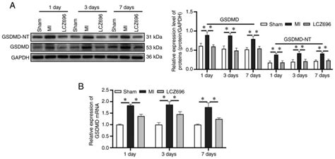 Sacubitril Valsartan Lcz Reduces Myocardial Injury Following