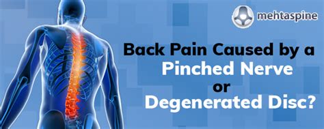 Back Pain Caused By Pinched Nerve Back Pain Specialist In Edgbaston