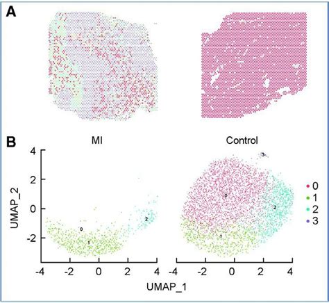 Spatial transcriptomics data from human control and MI hearts. A ...