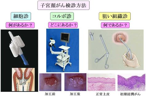 組織 検査