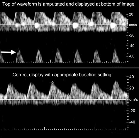 A Radiologists Guide To The Performance And Interpretation Of