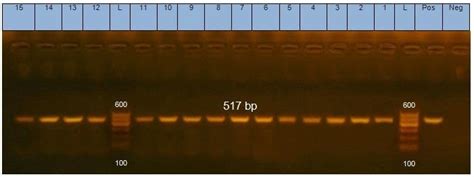 Agarose Gel Shows A Polymerase Chain Reaction PCR Amplified Product