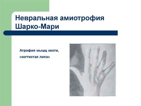 Нервно-мышечные заболевания - online presentation