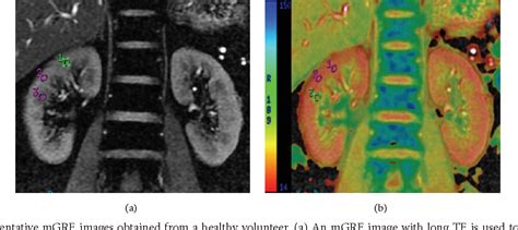 Figure 1 From Review Article Functional Magnetic Resonance Imaging In