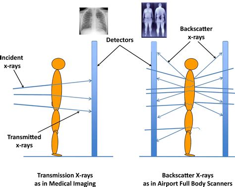 Airport Full Body Scanners Journal Of The American College Of Radiology