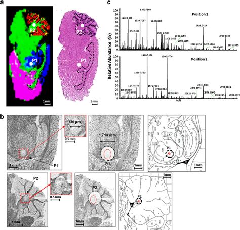 Maldi Msi Molecular Classification Of Tissue Section A Left Download Scientific Diagram