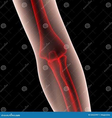 Human Elbow Joint Stock Illustration Illustration Of Osteoporosis