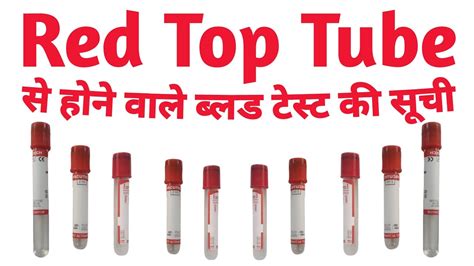 Blood Test List Perform In Red Top Tube YouTube