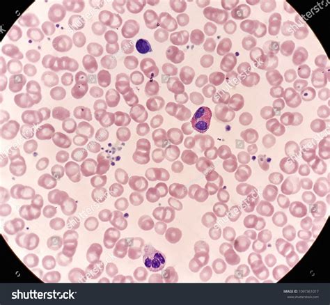 Human Blood Smear Under 100x Light Stock Photo 1097361017 Shutterstock