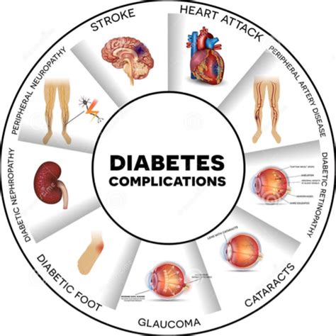 Diabetes Flashcards Quizlet