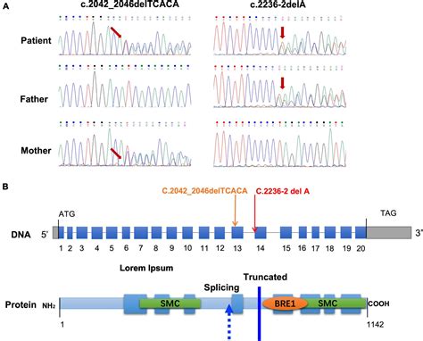 Frontiers Novel Compound Heterozygous Ccdc Mutations In A Familial