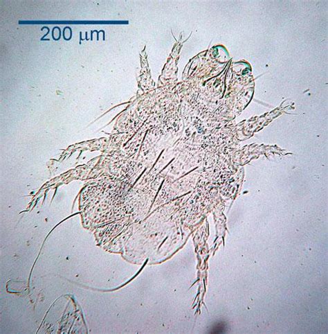 Cheyletiella An Overview ScienceDirect Topics 59 OFF