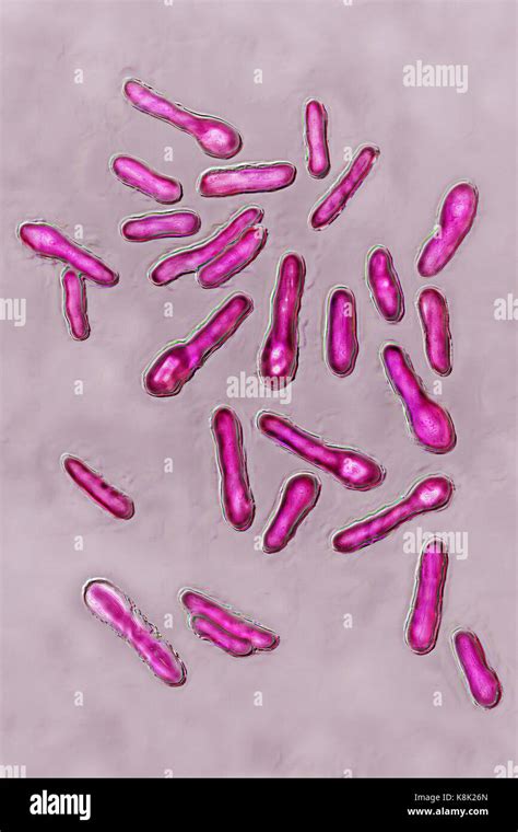 Clostridium Botulinum Stock Photo 160229405 Alamy