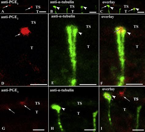 Immunostaining Of The Sensory Endings And Glandular Ducts In The Distal