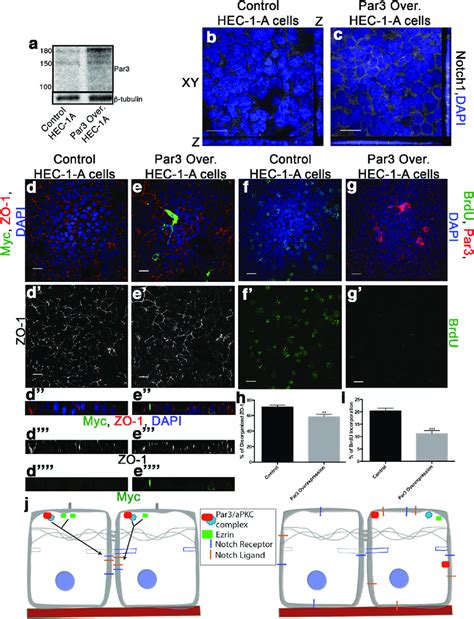 Expressing Par In Endometrial Cancer Cell Lines Blocks Proliferation