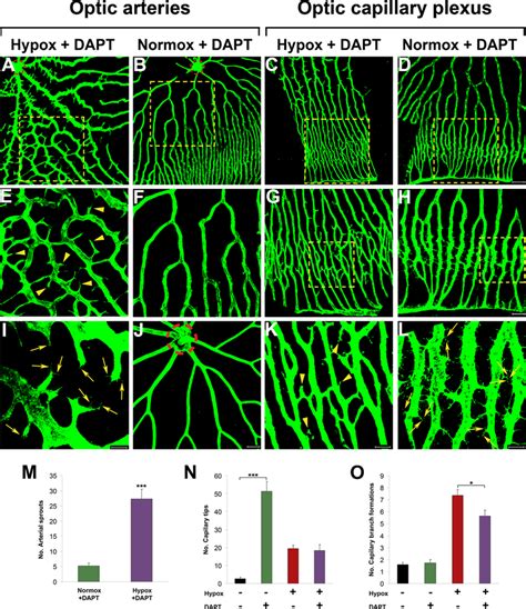 Inhibition Of Notch Under Hypoxia And Normoxia Adult Fli EGFP Tg