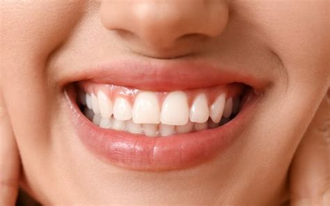 Healthy Gums Best Easy Tips To Keep Your Gums Healthy