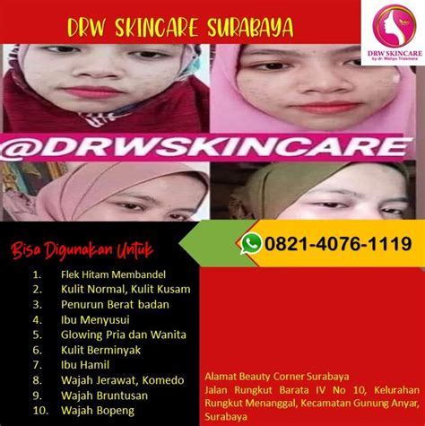 WA 0821 4076 1119 Bedak Padat Remaja 16 Tahun Drw Skincare Sumenep By