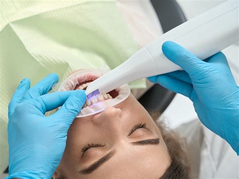 Intraoral Scanning Joseph Barclay