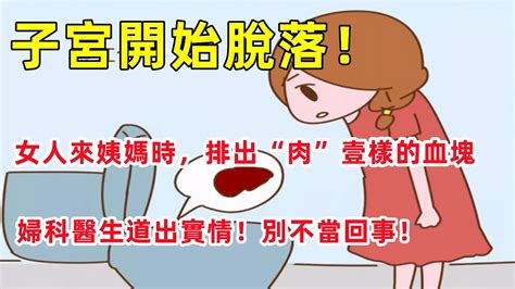 子宮開始脫落！女人來姨媽時，排出“肉”壹樣的血塊，是爲什麽？婦科醫生道出實情！別不當回事！女性健康健康常识 Youtube