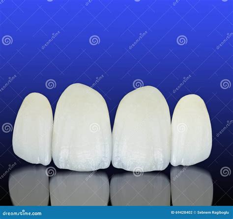 Dental Overlay Royalty-Free Stock Image | CartoonDealer.com #29102326